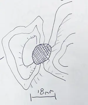 Hoarding knot 18mm - 211110 1735 Tiny Things 2.png